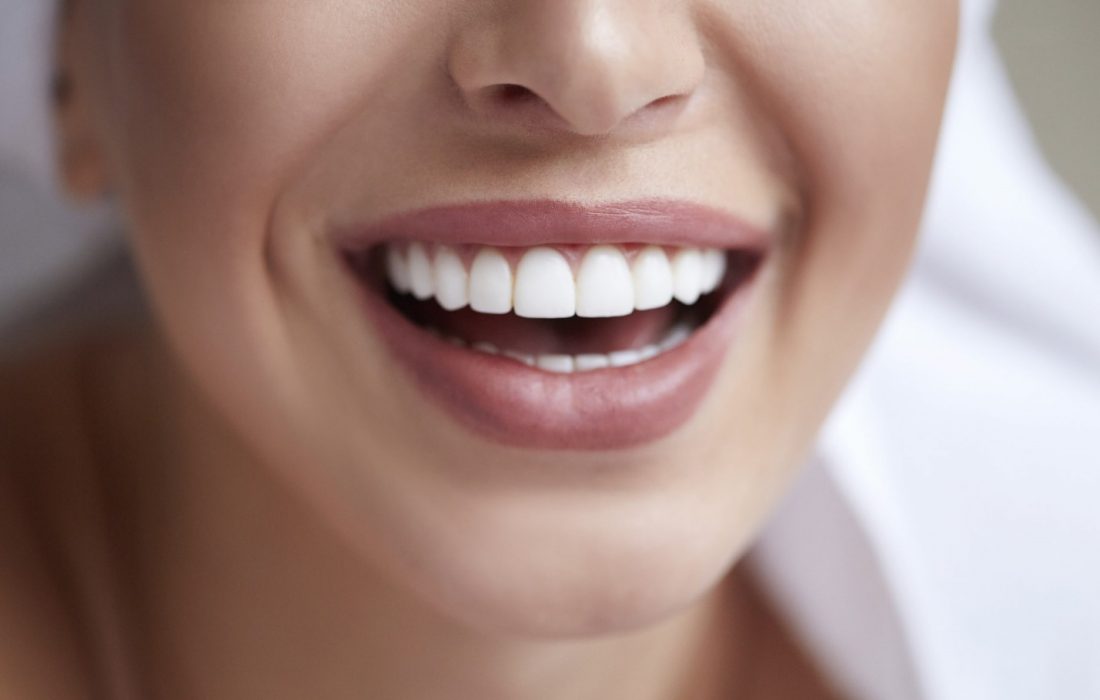 لورس :اهمیت استفاده از کامپوزیت دندان