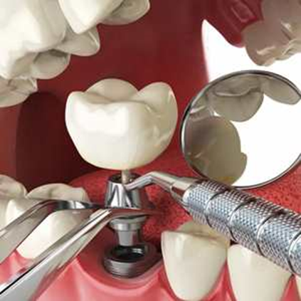 دلایل شایع دندان درد و درمان آن